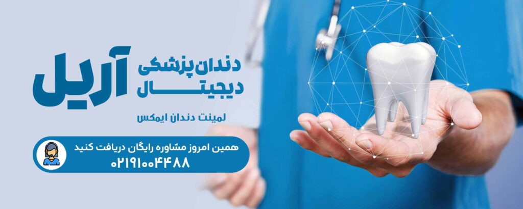 لمینت دندان ایمکس