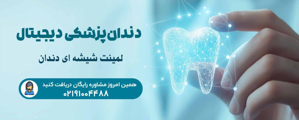 لمینت شیشه ‌ای دندان