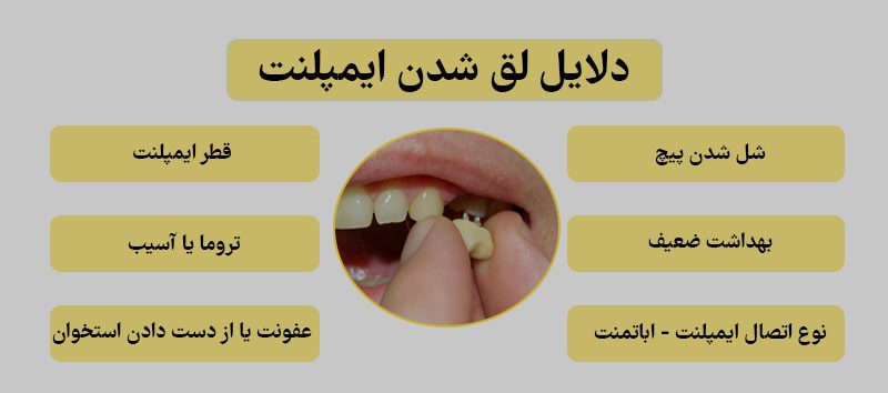 لق شدن ایمپلنت دندان