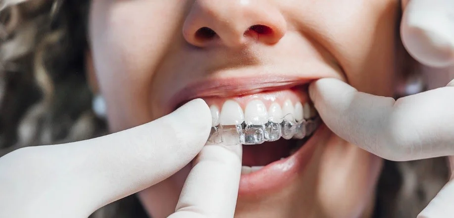 تاثیرگذاری الاینرهای شفاف