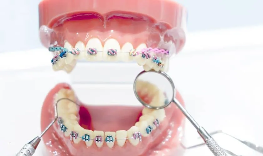 All about dental orthodontics