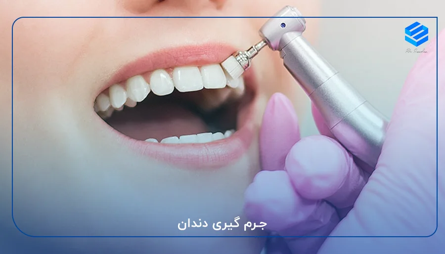 زیبایی دندان کم هزینه