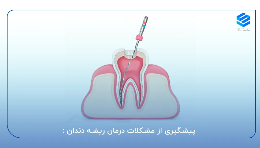 درمان ریشه دندان ;Root Canal Therapy 