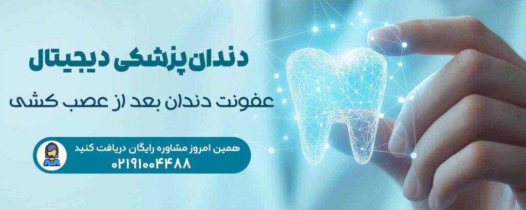 عفونت دندان بعد از عصب کشی