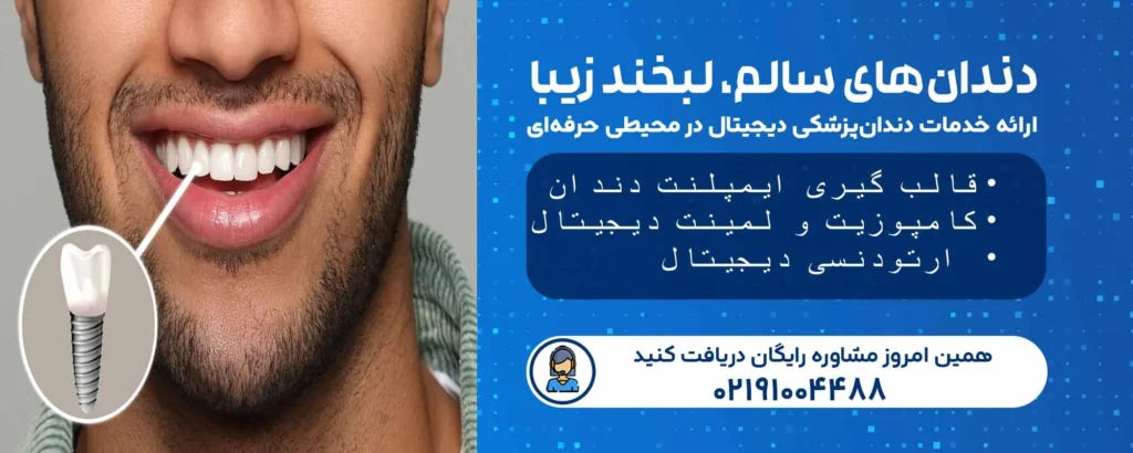 قالب‌ گیری ایمپلنت دندان