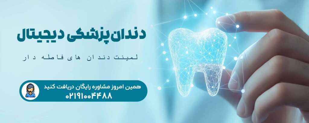 لمینت دندان ‌های فاصله‌ دار