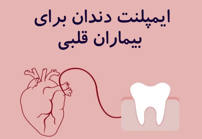 ایمپلنت دندان برای بیماران قلبی