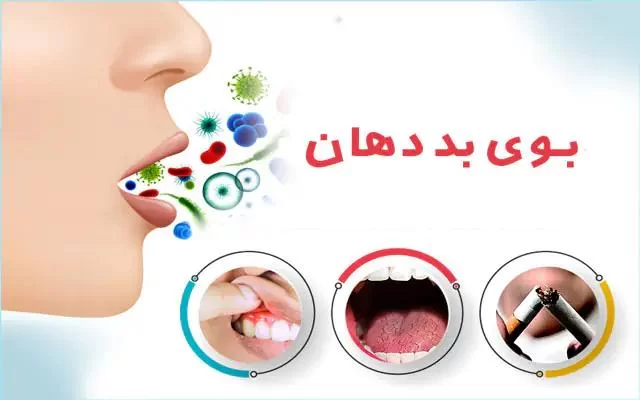 درمان بوی بد دهان