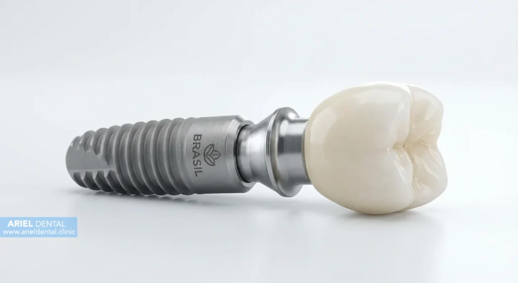 ارزش واقعی قیمت ایمپلنت برزیلی