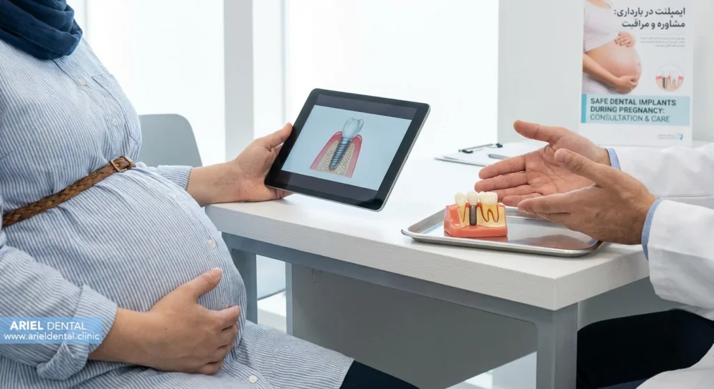 چه زمانی ایمپلنت در بارداری ضرورت پیدا میکند