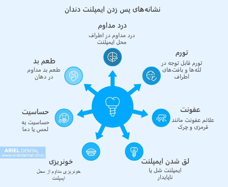 نشانه های رایج پس زدن ایمپلنت دندان