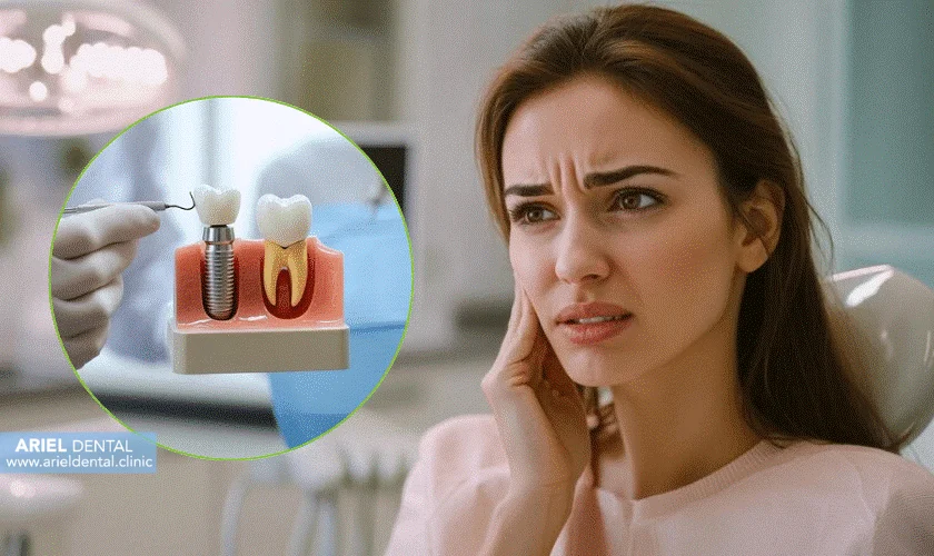 شکست ایمپلنت دندان