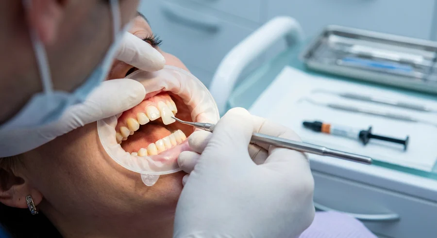 لمینت دندان اقساطی در تهران