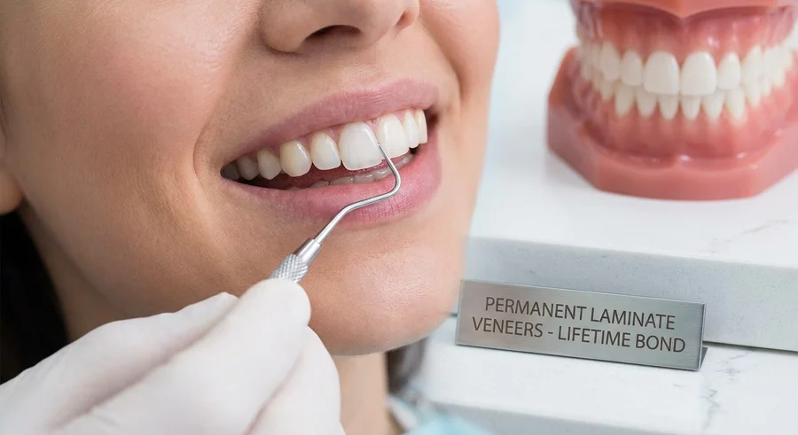 آیا لمینت دندان دائمی است