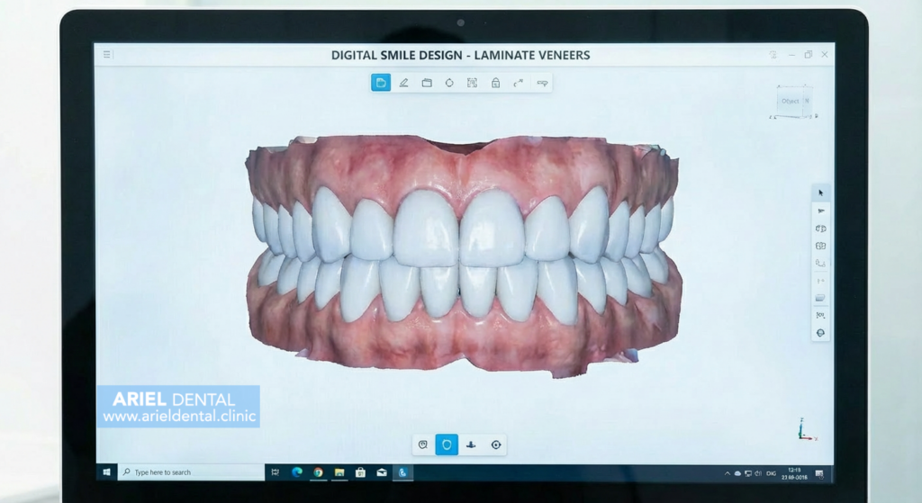 قیمت لمینت سرامیکی